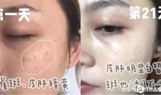 去黄美白产品排行榜